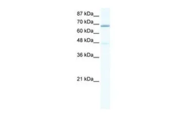 Anti-Cav beta 2 antibody, C-term used in Western Blot (WB). GTX47457