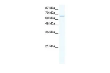 Anti-Cav beta 2 antibody, N-term used in Western Blot (WB). GTX47458