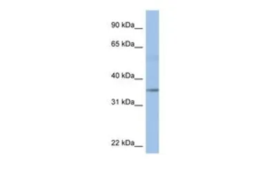 Anti-KCTD4 antibody, Internal used in Western Blot (WB). GTX47460