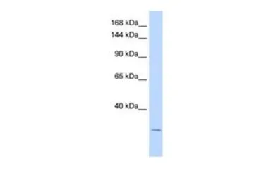 Anti-KCNK6 antibody, N-term used in Western Blot (WB). GTX47461