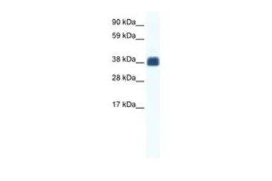 Anti-Connexin 36 antibody, Internal used in Western Blot (WB). GTX47465