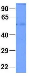 Anti-GJA9 antibody, Internal used in Western Blot (WB). GTX47481