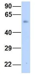 Anti-GJA9 antibody, Internal used in Western Blot (WB). GTX47481