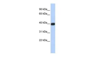 Anti-Connexin 36 antibody, Internal used in Western Blot (WB). GTX47483