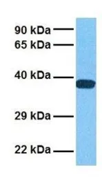 Anti-Connexin 36 antibody, Internal used in Western Blot (WB). GTX47483