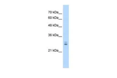 Anti-KCTD11 antibody, N-term used in Western Blot (WB). GTX47532