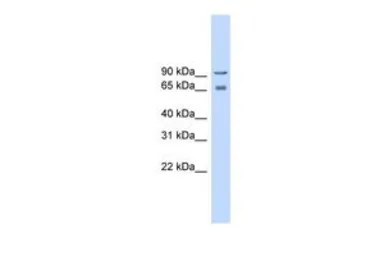 Anti-Cav beta 2 antibody, Internal used in Western Blot (WB). GTX47534