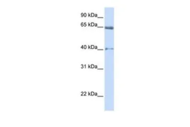 Anti-Cav beta 2 antibody, Internal used in Western Blot (WB). GTX47537