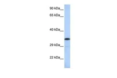 Anti-KCTD4 antibody, Internal used in Western Blot (WB). GTX47613