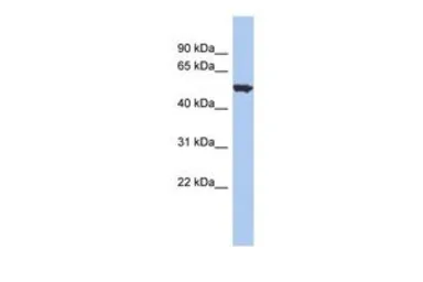 Anti-ACCN1 antibody, Internal used in Western Blot (WB). GTX47614