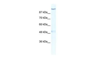 Anti-KCNH6 antibody, Internal used in Western Blot (WB). GTX47622