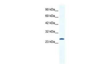 Anti-Cav gamma 6 antibody, N-term used in Western Blot (WB). GTX47638