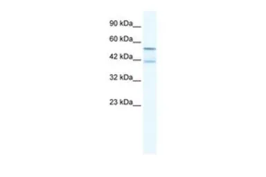 Anti-KCNK10 antibody, N-term used in Western Blot (WB). GTX47639