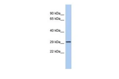 Anti-Cav gamma 6 antibody, N-term used in Western Blot (WB). GTX47649