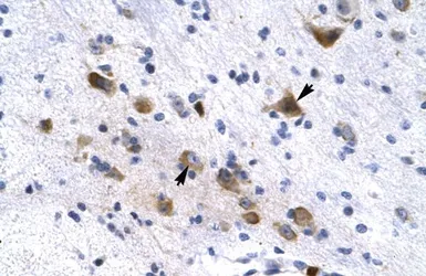 Anti-KCNH6 antibody, N-term used in IHC (Paraffin sections) (IHC-P). GTX47651