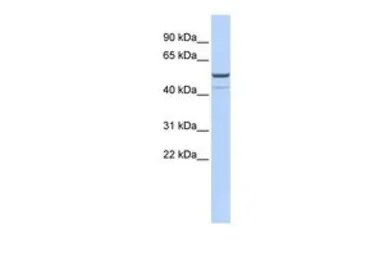 Anti-KCNK12 antibody, Internal used in Western Blot (WB). GTX47654