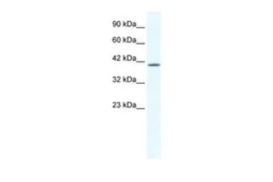 Anti-KCNK13 antibody, C-term used in Western Blot (WB). GTX47655