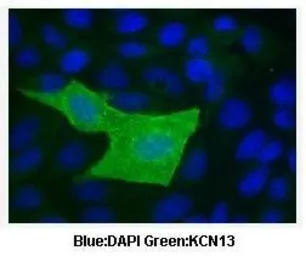 Anti-KCNK13 antibody, C-term used in Immunocytochemistry/ Immunofluorescence (ICC/IF). GTX47656