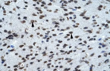 Anti-KCNK13 antibody, C-term used in IHC (Paraffin sections) (IHC-P). GTX47656