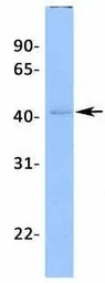 Anti-KCNK13 antibody, C-term used in Western Blot (WB). GTX47656