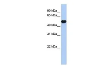 Anti-Kir2.2 antibody, Internal used in Western Blot (WB). GTX47662