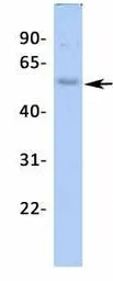 Anti-Kir2.2 antibody, Internal used in Western Blot (WB). GTX47662