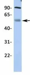 Anti-Kir2.2 antibody, Internal used in Western Blot (WB). GTX47662