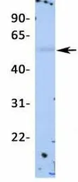 Anti-Kir2.2 antibody, Internal used in Western Blot (WB). GTX47662