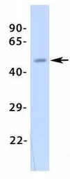 Anti-Kir2.2 antibody, Internal used in Western Blot (WB). GTX47662