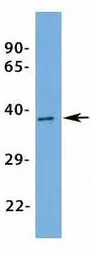 Anti-KCNK9 antibody, N-term used in Western Blot (WB). GTX47674