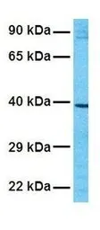 Anti-KCNK9 antibody, N-term used in Western Blot (WB). GTX47674