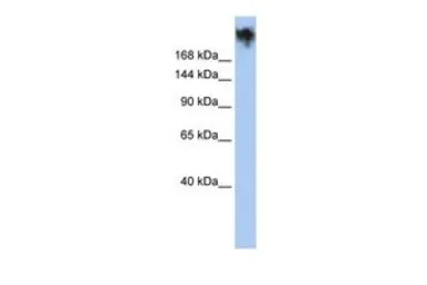 Anti-PKDREJ antibody, Internal used in Western Blot (WB). GTX47680