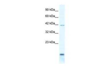 Anti-P2X6 antibody, N-term used in Western Blot (WB). GTX47685