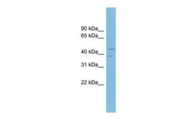 Anti-P2X6 antibody, N-term used in Western Blot (WB). GTX47686