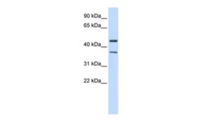 Anti-KIR2.3 antibody, Internal used in Western Blot (WB). GTX47688