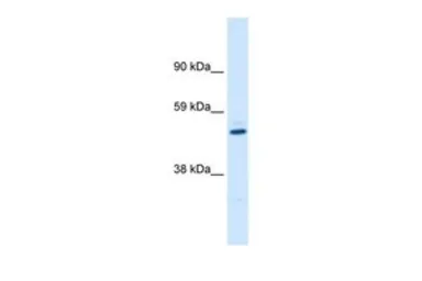 Anti-Kv beta 1 antibody, C-term used in Western Blot (WB). GTX47690