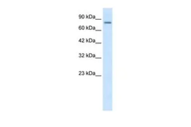 Anti-KCNN3 antibody, C-term used in Western Blot (WB). GTX47693