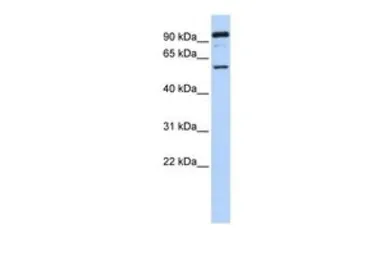 Anti-GABRR1 antibody, N-term used in Western Blot (WB). GTX47697