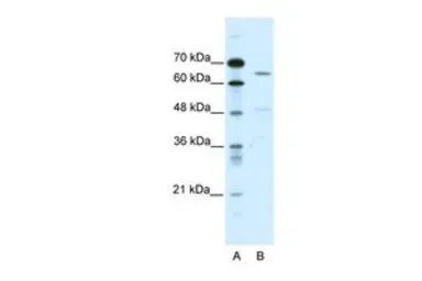 Anti-ACCN1 antibody, C-term used in Western Blot (WB). GTX47700