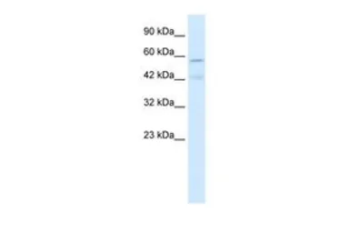 Anti-AChR alpha 5 antibody, Internal used in Western Blot (WB). GTX47703