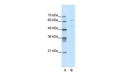 Anti-CACNB3 antibody, C-term used in Western Blot (WB). GTX47705