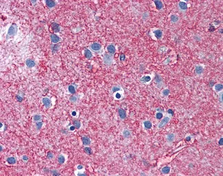 Anti-EAAT2 antibody, Internal used in IHC (Paraffin sections) (IHC-P). GTX47745