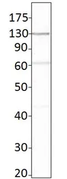 Anti-Adenylate cyclase 6 antibody used in Western Blot (WB). GTX47798