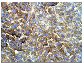 Anti-Vitamin K epoxide reductase antibody used in IHC (Paraffin sections) (IHC-P). GTX47837