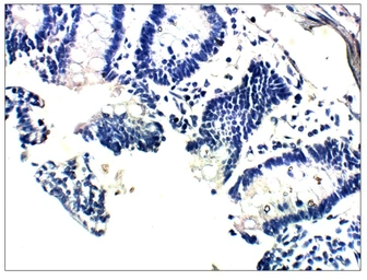 Anti-Vitamin K epoxide reductase antibody used in IHC (Paraffin sections) (IHC-P). GTX47837