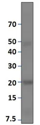 Anti-Vitamin K epoxide reductase antibody used in Western Blot (WB). GTX47837