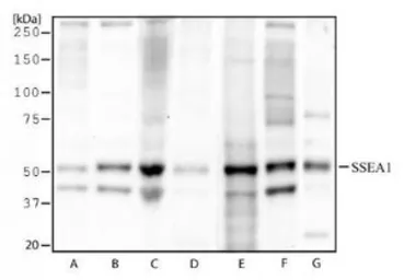 Anti-SSEA-1 / CD15 antibody [MC-480] used in Western Blot (WB). GTX48035