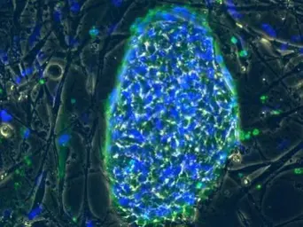 Anti-SSEA-4 antibody [MC-813-70] used in Immunocytochemistry/ Immunofluorescence (ICC/IF). GTX48037