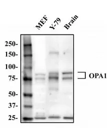 Anti-OPA1 antibody used in Western Blot (WB). GTX48589