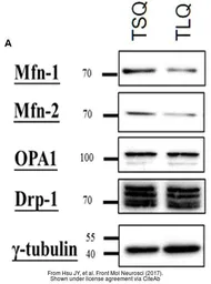 Anti-OPA1 antibody used in Western Blot (WB). GTX48589